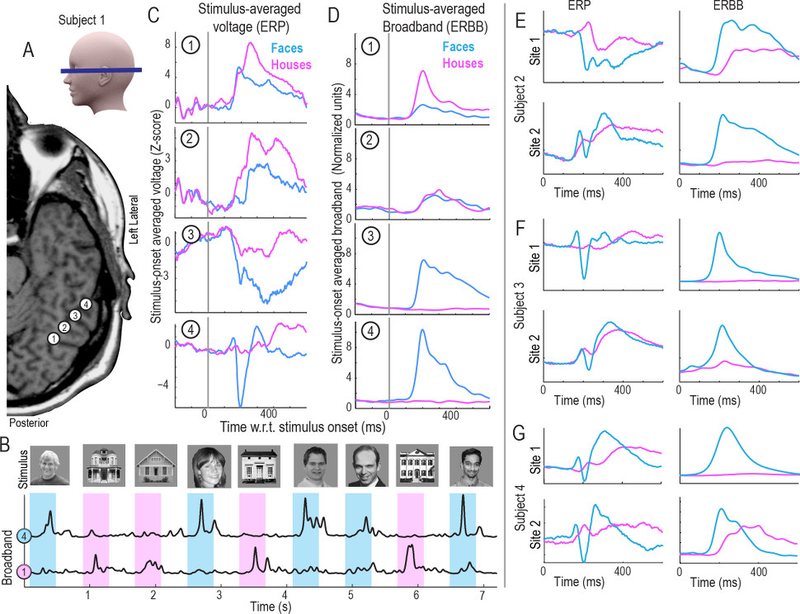 Illustration for article titled New Technique Allows Scientists to Read Minds at Nearly the Speed of Thought